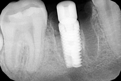 Визиограф ( Рентген зуба) в Медицинском центре Сонар Улан-Удэ